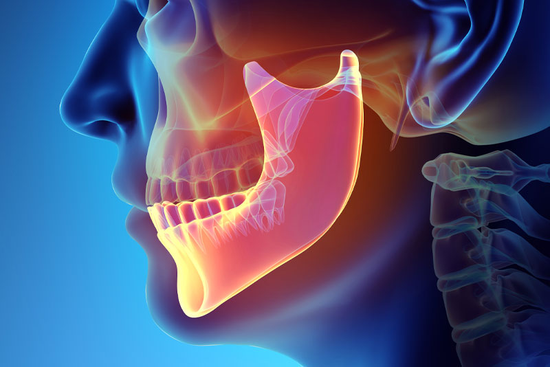 jaw bone model